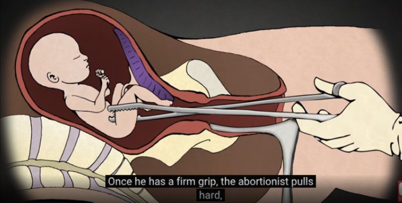 Planned Parenthood Needs To Be Shut Down –And This Lawsuit Shows Why