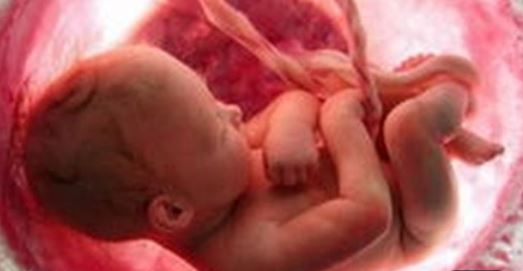 Who Shouldn’t Pay for Abortions?